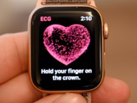 AppleWatch又一次救了年轻人的命ECG功能给出了重要信息