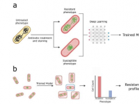 研究表明人工智能如何在短短30分钟内检测抗生素耐药性