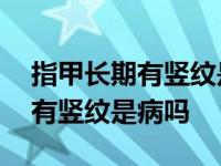 指甲长期有竖纹是身体的什么信号 指甲长期有竖纹是病吗 