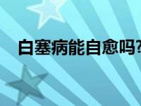 白塞病能自愈吗? 白塞病要治疗一辈子吗 