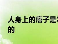 人身上的痦子是怎么形成的 痦子是怎么形成的 