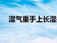 湿气重手上长湿疹怎么办 长湿疹怎么办 