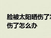 脸被太阳晒伤了怎么办通红疼痛 脸被太阳晒伤了怎么办 