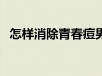 怎样消除青春痘男生 怎样才能消除青春痘 