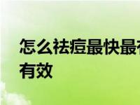 怎么祛痘最快最有效小学生 怎么祛痘最快最有效 