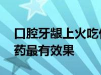 口腔牙龈上火吃什么药最有效果 上火吃什么药最有效果 