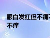 眼白发红但不痛不痒怎么办 眼白发红但不痛不痒 