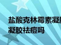 盐酸克林霉素凝胶能治痘痘吗 盐酸克林霉素凝胶祛痘吗 