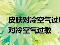 皮肤对冷空气过敏怎么治该用什么药好 皮肤对冷空气过敏 