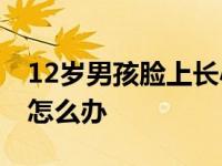 12岁男孩脸上长小痘痘怎么办 脸上长小痘痘怎么办 