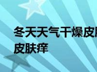 冬天天气干燥皮肤痒用什么药 冬天天气干燥皮肤痒 