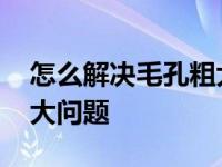 怎么解决毛孔粗大问题女生 怎么解决毛孔粗大问题 