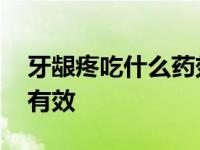 牙龈疼吃什么药效果最好 牙龈疼吃什么药最有效 