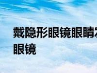 戴隐形眼镜眼睛发红充血是怎么回事 戴隐形眼镜 