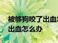 被够狗咬了出血怎么办要打针吗 被够狗咬了出血怎么办 