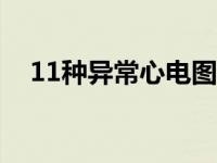 11种异常心电图 心电图报告单正常范围 