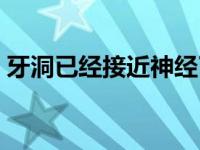 牙洞已经接近神经了 牙洞深到神经还能补吗 