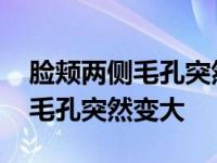 脸颊两侧毛孔突然变大还会缩小吗 脸上两颊毛孔突然变大 