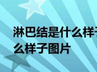 淋巴结是什么样子图片真人内部 淋巴结是什么样子图片 