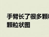 手臂长了很多颗粒状图长大了 手臂长了很多颗粒状图 