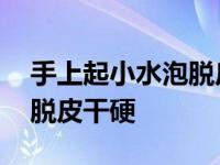 手上起小水泡脱皮干硬怎么办 手上起小水泡脱皮干硬 