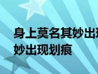 身上莫名其妙出现划痕伤口照片 身上莫名其妙出现划痕 