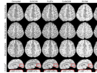 科学家创建模型使 MRI 更加准确可靠